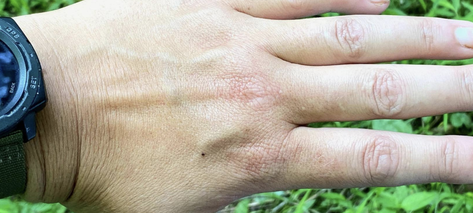 Close-up of a hand with a dark watch on the wrist. The hand is positioned palm down, showing the skin and veins, against a green outdoor background.